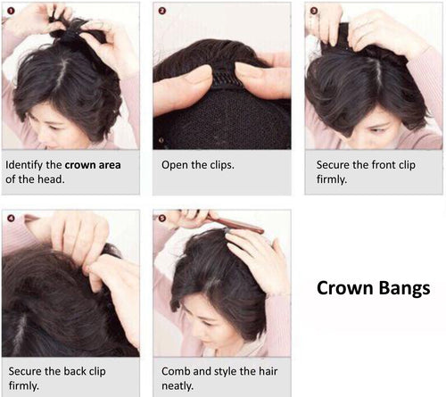 Crown Baldness Topper